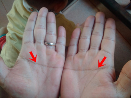 Bàn tay có đặc điểm này không phú cũng quý, cả đời may mắn Bàn tay có đặc điểm này không phú cũng quý, cả đời may mắn