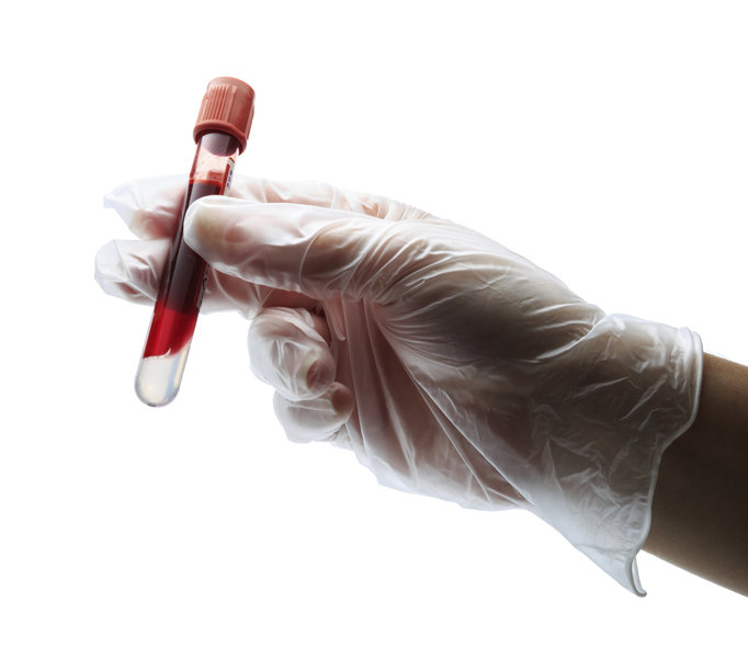 Hướng dẫn cách đọc kết quả xét nghiệm máu