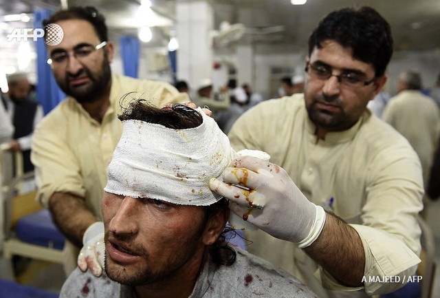 Các bác sĩ ở Pakistan chăm sóc một người bị thương
