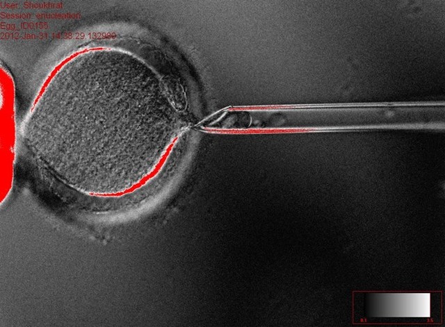 Các nhà nghiên cứu từ ĐH Y tế và khoa học Oregon (Mỹ) tuyên bố đã tạo thành công tế bào gốc phôi thai người bằng kỹ thuật nhân bản vô tính tế bào da người. Họ lấy các tế bào da trên cơ thể một người trưởng thành rồi đặt nhân của tế bào vào bên trong trứng mà họ đã bỏ nhân. Sau đó, họ dùng điện để kích thích trứng phát triển thành phôi thai.