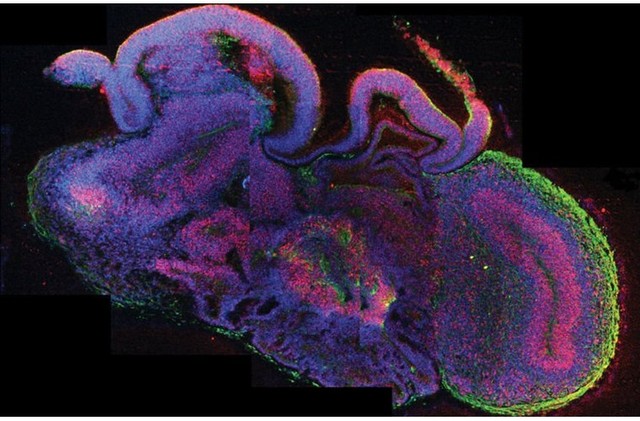 Các nhà nghiên cứu tại Viện sinh học phân tử (IMB) tại Vienna, Áo đã lần đầu tiên nuôi cấy thành công một bộ não người thu nhỏ chứa các thành phần vỏ não, hồi hải mã và thậm chí là võng mạc từ các tế bào gốc. Các cấu trúc mô 3D sẽ cho phép các nhà nghiên cứu nghiên cứu về các giai đoạn đầu tiên trong quá trình phát triển não người với độ chi tiết cực cao.