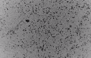 Australia: Tái tạo thành công virus Corona, giúp đẩy nhanh nghiên cứu vắc xin
