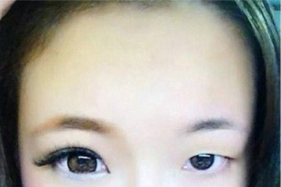 Điều cần biết trước khi sử dụng kính áp tròng