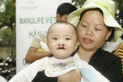 Vụ 3 trẻ tử vong vì phẫu thuật từ thiện: Bộ Y tế nói gì?