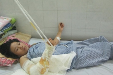 Nghi vợ ngoại tình, chồng hung hãn chém đứt lìa tay vợ
