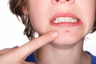 Bốn triệu chứng cho thấy độc tố trong cơ thể bạn quá cao