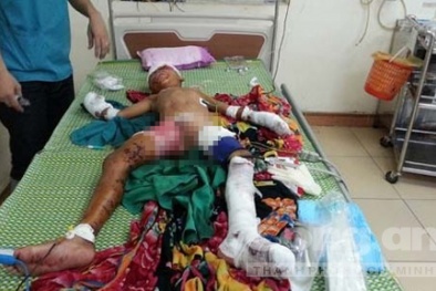 Nghệ An: Cháu bé đứt động mạch vì đồ chơi bỗng phát nổ