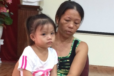 Bé 4 tuổi bị teo thực quản vì uống nhầm nước tro tàu làm bánh