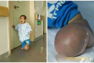 Rơi nước mắt trước cảnh cậu bé lê lết bước đi bằng đôi chân 'quả bóng'