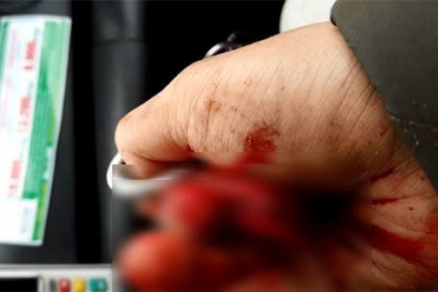 Nhà báo Đỗ Doãn Hoàng nói gì sau vụ bị côn đồ hành hung dã man?