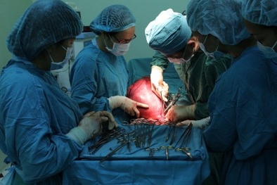 Bác sĩ choáng với khối u xơ tử cung gần 8 kg trong bụng bệnh nhân