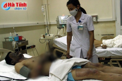 Bị tia lửa điện phóng, công nhân dự án Formosa nguy kịch