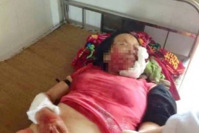 Chạy vạy vay tiền, gửi gắm bác sĩ sau khi chém vỡ mặt vợ