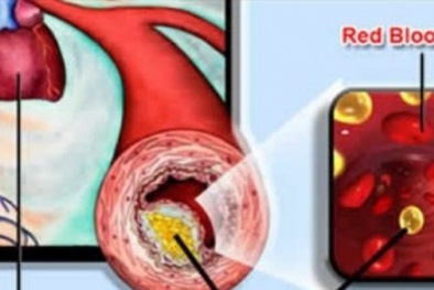 Việt Nam đối diện với 4 loại bệnh được coi là kẻ giết người hàng loạt