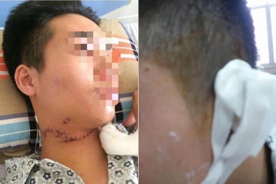 Thêm vụ tôn cứa cổ, đứt gần lìa tai học sinh trên phố Hà Nội