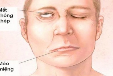 Trời lạnh đột ngột, người dùng cần giữ ấm tránh nguy cơ liệt mặt