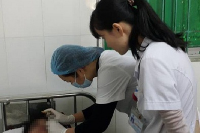 Cứu sống một bệnh nhân nghi bị đạn hoa cải găm trên mặt