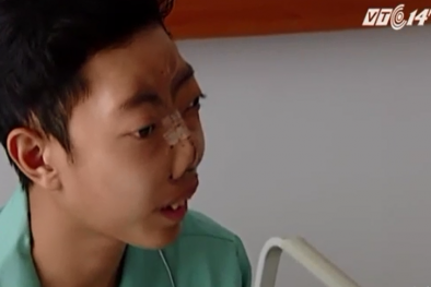 Bác sĩ Mỹ có bàn tay 'vàng' giúp chàng trai Việt tìm lại khuôn mặt