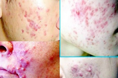 Mỹ phẩm kém chất lượng