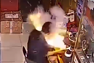 Người thợ bỏng mặt, suýt hỏng mắt vì nổ pin điện thoại