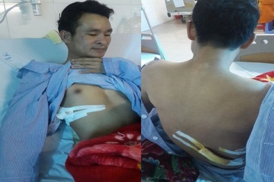 Khẩn trương điều tra làm rõ vụ thanh niên bị đâm khi cứu người bị tai nạn
