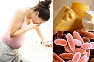 Ăn phô mai nhiễm khuẩn Listeria ảnh hưởng nghiêm trọng tới thai nhi