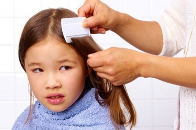Thuốc diệt bọ chét, chấy rận ảnh hưởng nghiêm trọng tới trẻ em