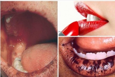 Nguy cơ nhiễm độc chì từ son môi