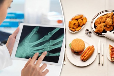 Thực phẩm chứa axit béo có thể khiến xương khớp trở nên 'mỏng manh'