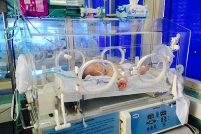 Uống mật khỉ chống sốt co giật, bé trai 5 ngày tuổi nguy kịch