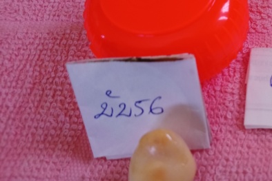 Một ngư dân Bạc Liêu bỗng thành tỷ phú nhờ bắt được ngọc ốc quý hiếm giá nửa tỷ