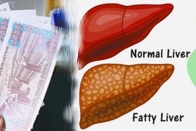 'Thần dược' chỉ 2 nghìn đồng nhưng giảm cân, đẹp da, thải độc gan kỳ diệu