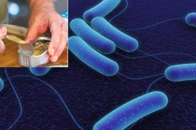 Ăn thịt nhiễm vi khuẩn Clostridium botulinum: Tác hại khủng khiếp thế nào?