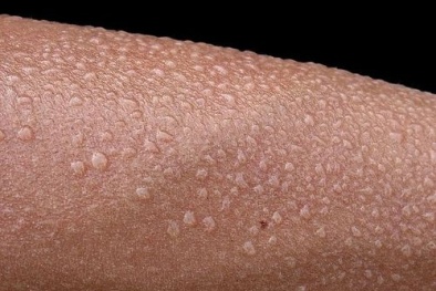 Sắp sạc pin điện thoại, nghe radio bằng điện lấy từ…mồ hôi?