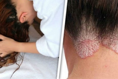 Có lười đến mấy cũng đừng bao giờ đi ngủ với mái tóc ẩm ướt vì 7 lý do sau