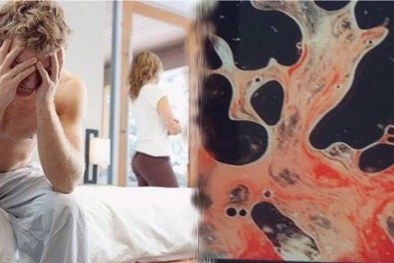 Đàn ông thấy dấu hiệu này ở tinh dịch có thể bị ung thư tuyến tiền liệt