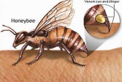 Nguy cơ chết người có thể từ 1 vết ong đốt