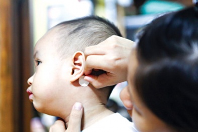 Dùng miếng dán say tàu xe dễ khiến con trẻ hôn mê, ngưng thở