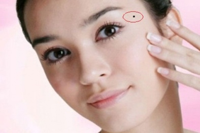 Vì sao con người có nốt ruồi và càng nhiều nốt ruồi càng khỏe mạnh?