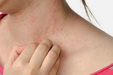 Nguy cơ dị ứng và mắc nhiều bệnh nguy hiểm từ quần áo mới mua