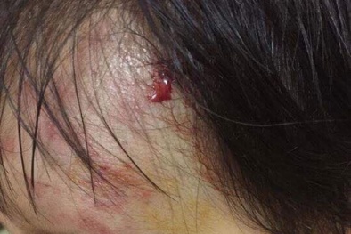 Nam thanh niên phóng xe phân khối lớn đâm bé gái 11 tháng tuổi rồi bỏ chạy