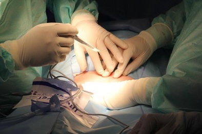 Trước mổ đẻ và những điều 'bất di bất dịch' cần nhớ nếu không muốn mất mạng
