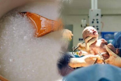 Thai phụ tử vong vì lén ăn cháo trước khi lên bàn mổ: Vì sao phải nhịn ăn?