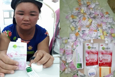 Tróc da, mặt sưng tấy vì dị ứng mỹ phẩm Thái Lan