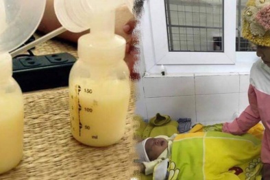 Bé gái 16 ngày tuổi loét thủng giác mạc hai mắt vì 'mẹo' nhỏ sữa mẹ vào mắt
