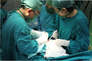 Người đàn ông thủng đại tràng vì thói quen vừa ngậm tăm vừa uống nước
