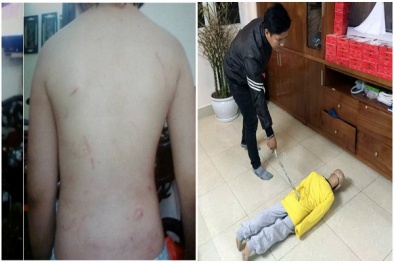 Bé trai 10 tuổi bị bố đẻ bạo hành: Bé bị sang chấn tâm lý nghiêm trọng và ám ảnh suốt đời