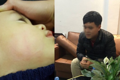 Bé trai 22 tháng tuổi bị bác sĩ tát đỏ mặt tại phòng khám vì 'cơn nóng giận nhất thời'