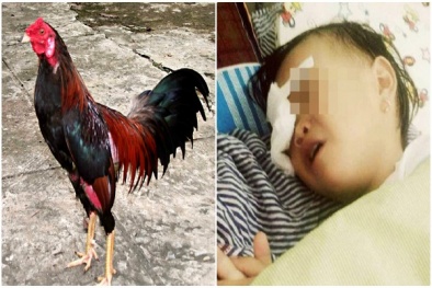 Bé 2 tuổi bất ngờ bị gà chọi 'tung cước' hỏng một mắt