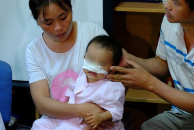 Chó nhà bỗng dưng 'phát khùng' lao vào cắn bé 1 tuổi đứt mũi